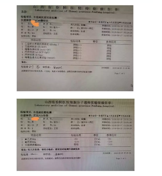 确诊为艾滋病