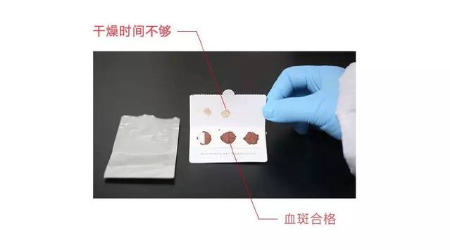 检测人员收到干血斑样本后，检查干血斑是否合格
