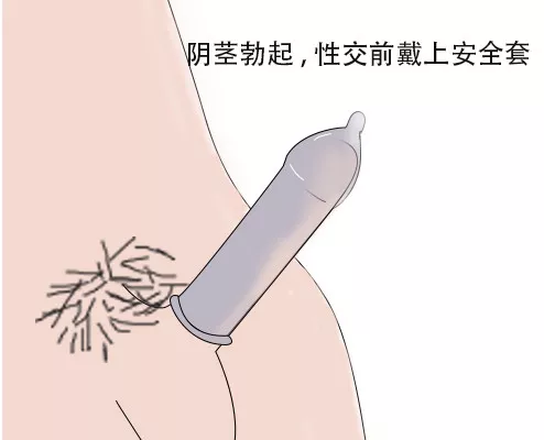05  应在阴茎勃起以后，进行性交前戴上安全套（注意正反哦！）。