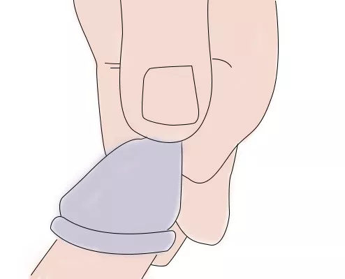 07  套上安全套前，应先捏瘪安全套顶端的小气囊。
