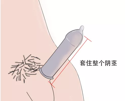 09  使用时让安全套套住整个阴茎。
