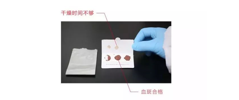 合格的血斑
