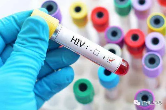 HIV血液试管