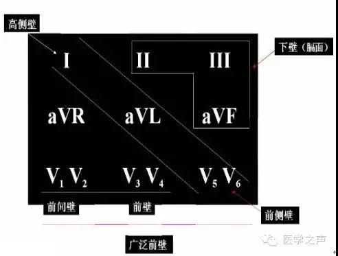 关于心梗定位问题
