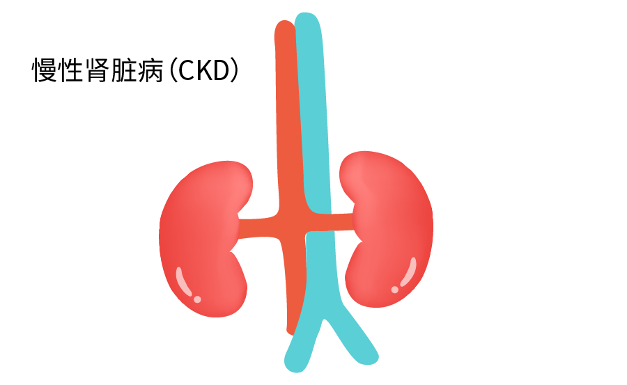慢性肾脏病（CKD）
