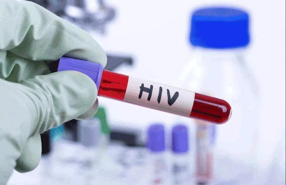 美国CDC便推荐，每一名13-64岁的人，都应至少接受一次HIV检测。