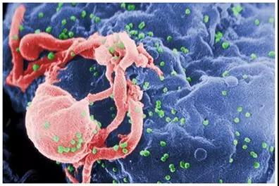 出生时携带HIV病毒的婴儿 应当尽早开始接受治疗