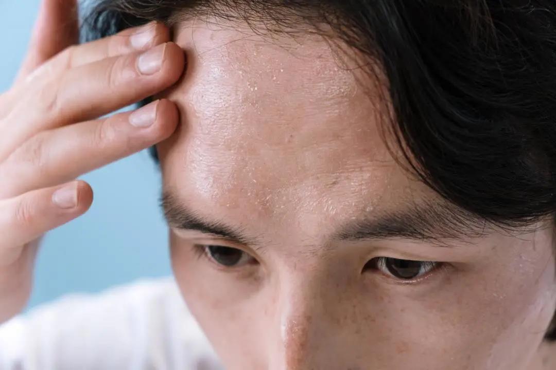 症状